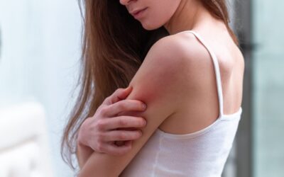 Dermatite atopica: la nemica della pelle