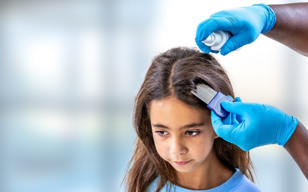 Pediculosi: come prevenirla e curarla